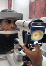 screening for diabetic retinopathy